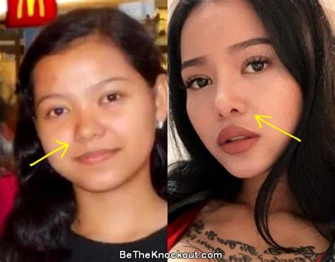 Bella Poarch Plastic Surgery Comparison Photos